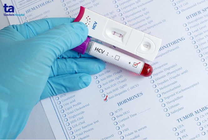 Viêm gan C lây như thế nào?